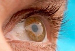 علل شایع خشکی چشم