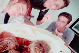 سلفی با اجساد توسط دانشجویان پزشکی ایرانی !